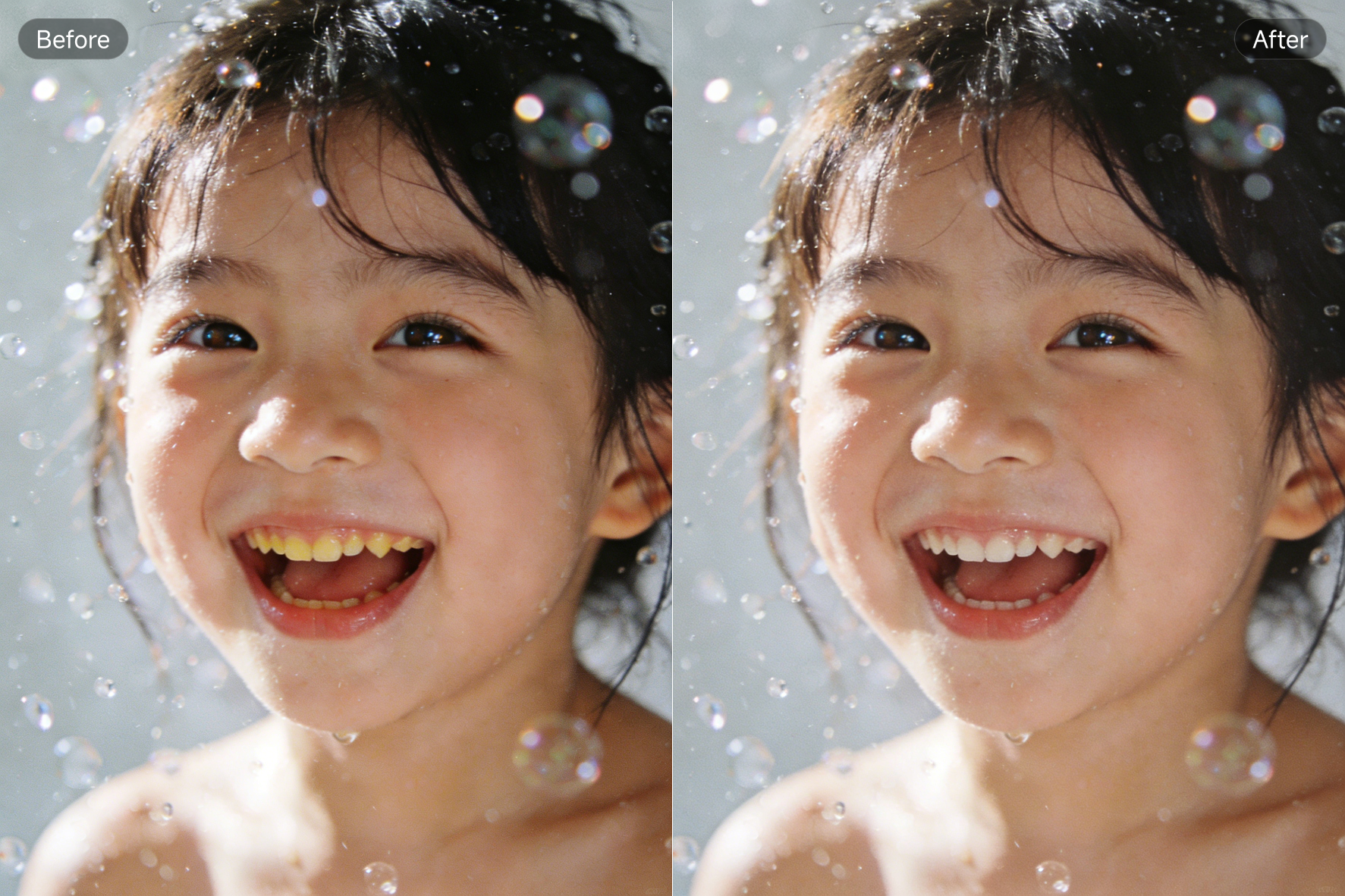 PixPretty Teeth Whitening