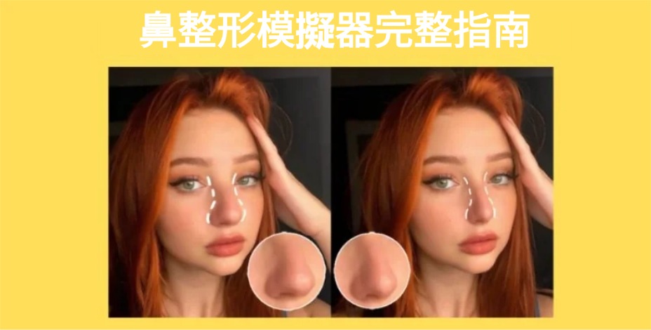 免費鼻整形模擬器
