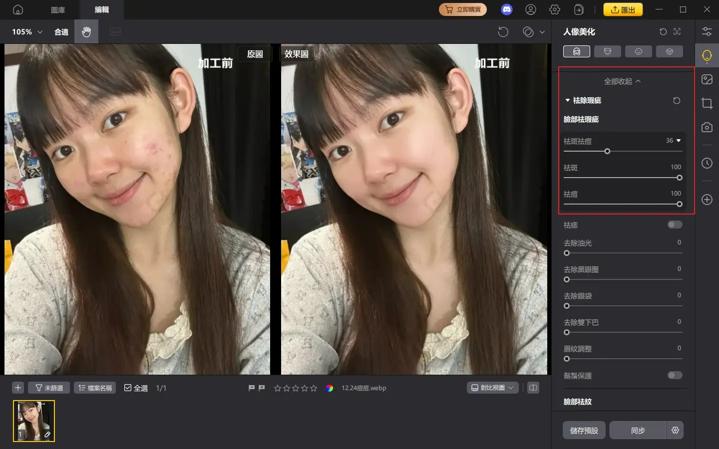 PixPretty AI 美顏祛痘功能